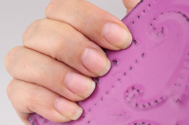 Nail-Medic-3-steps-to-Healthy-nails-before-pic-3