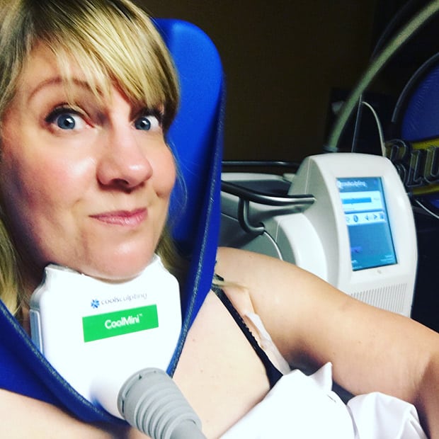Blonde woman hooked up to a cool sculpting machine