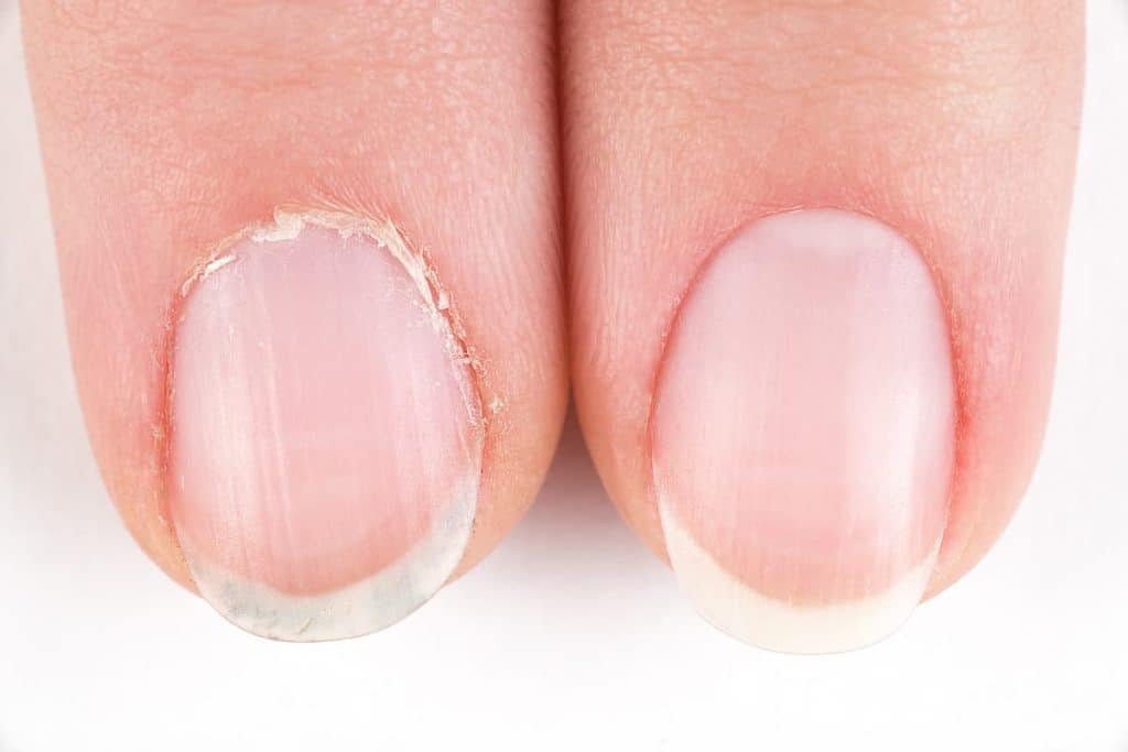 comparing a finger nail with unclean cuticle and a nail with a pampered cuticle on a white background