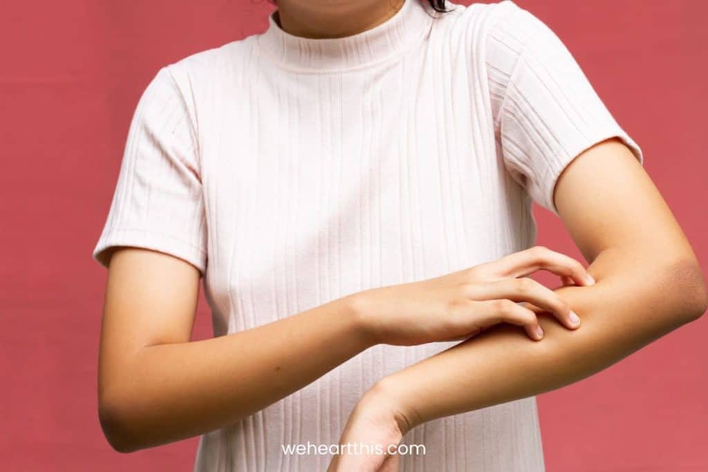 a woman wearing a cream turtle neck top scratching her arms due to allergy