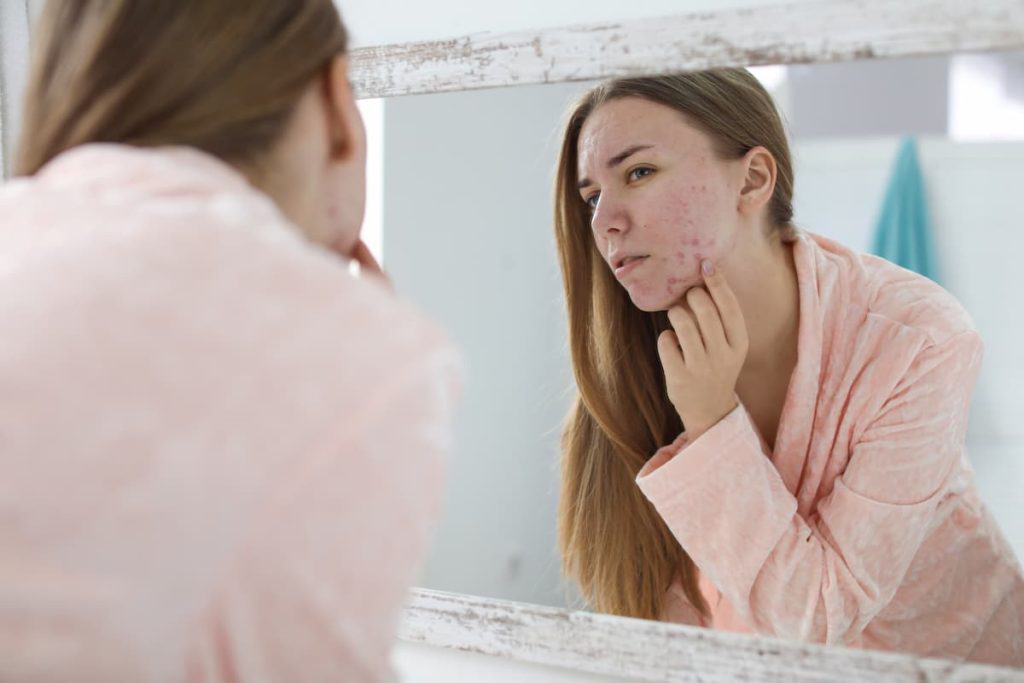 A woman in a pink pajama looking at her face with acne in the mirror.
