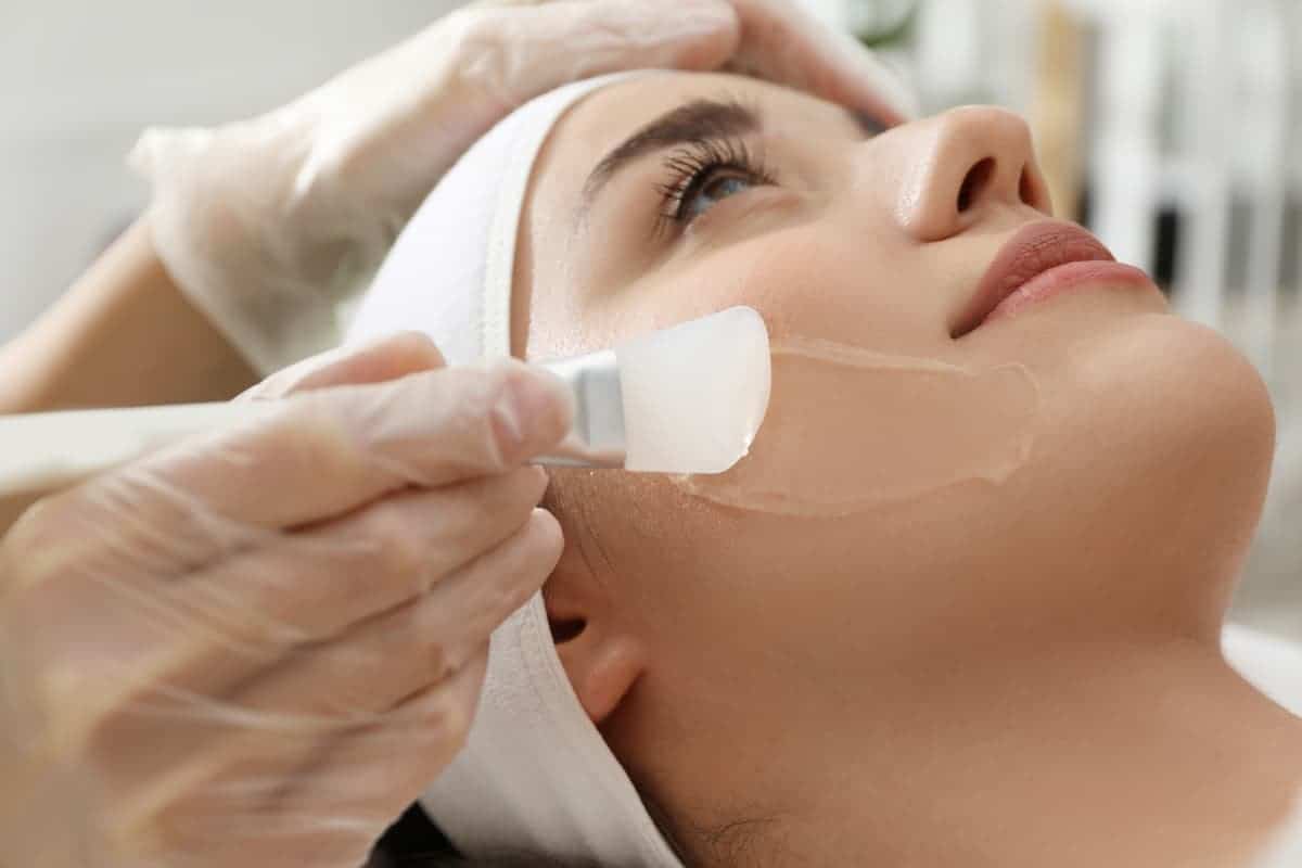 9 Best atHome Chemical Peels for Hyperpigmentation